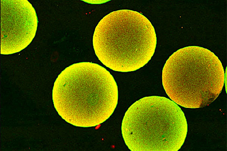 Protein Gel Could Help Treat Type 1 Diabetes | New Scientist